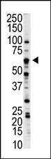 Anti-NLK Rabbit Polyclonal Antibody (Biotin)