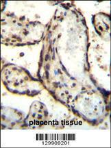 Anti-HEXIM1 Rabbit Polyclonal Antibody (FITC (Fluorescein Isothiocyanate))