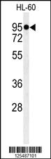 Anti-GAA Rabbit Polyclonal Antibody