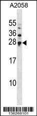 Anti-UBE2H Rabbit Polyclonal Antibody