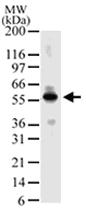 Anti-MBD4 Rabbit Polyclonal Antibody