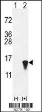 Anti-ISG15 Rabbit Polyclonal Antibody (FITC (Fluorescein))