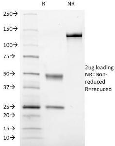 SDS-PAGE analysis of Anti-CD41a Antibody [ITGA2B/1036] under non-reduced and reduced conditions; showing intact IgG and intact heavy and light chains, respectively. SDS-PAGE analysis confirms the integrity and purity of the antibody.