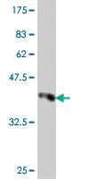 Anti-NUDT5 Mouse Polyclonal Antibody