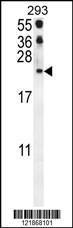 Anti-CCL21 Rabbit Polyclonal Antibody (HRP (Horseradish Peroxidase))