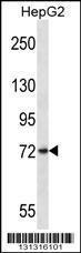 Anti-FRMD7 Rabbit Polyclonal Antibody (AP (Alkaline Phosphatase))