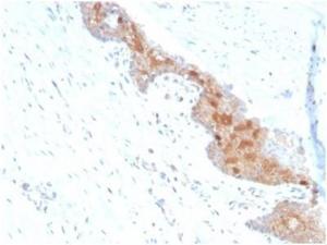 Immunohistochemical analysis of formalin-fixed, paraffin-embedded human prostate tissue using Anti-MIF Antibody [MIF/4336]