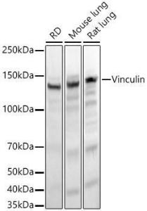 Anti-Vinculin Rabbit Monoclonal Antibody [clone: ARC51900]