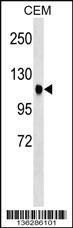 Anti-ATXN7 Rabbit Polyclonal Antibody