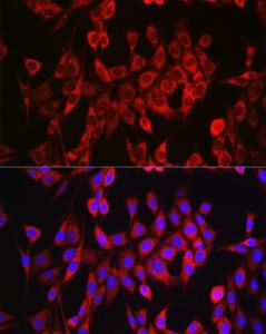 Antibody anti-GLS 100 µl