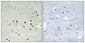 Immunohistochemical analysis of paraffin-embedded human brain using Anti-MAPKAPK2 (phospho Thr334) Antibody. The right hand panel represents a negative control, where the antibody was pre-incubated with the immunising peptide.