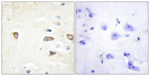 Immunohistochemical analysis of paraffin-embedded human brain tissue using Anti-MRCKB Antibody. The right hand panel represents a negative control, where the antibody was pre-incubated with the immunising peptide