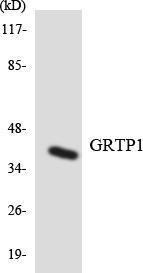 Western blot analysis of the lysates from Jurkat cells using Anti-GRTP1 Antibody