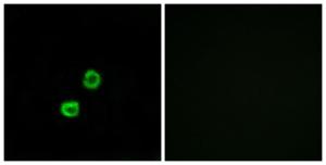 Immunofluorescence analysis of MCF7 cells using Anti-GCNT7 Antibody. The right hand panel represents a negative control, where the Antibody was pre-incubated with the immunising peptide