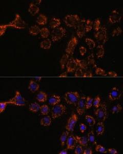 Immunofluorescence analysis of A431 cells using Anti-HSPA4L Antibody (A306461) at a dilution of 1:100. DAPI was used to stain the cell nuclei (blue)