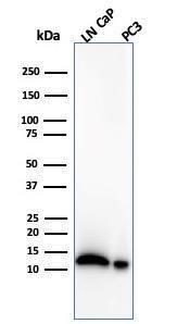 Western blot analysis of (Lane 1) LNCaP cell line lysate and (Lane 2) PC3 cell line lysate using Anti-MIF Antibody [MIF/4336]