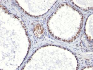 Anti-Androgen Receptor Mouse Monoclonal Antibody [clone: AR441]