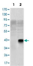 Anti-OLIG2 Mouse Monoclonal Antibody [clone: 1G11]