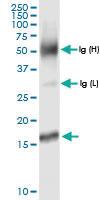 Anti-MTP18 Rabbit Polyclonal Antibody