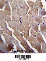 Anti-VILL Rabbit Polyclonal Antibody (Biotin)