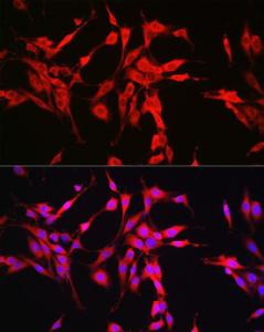 Antibody anti-GLS 100 µl