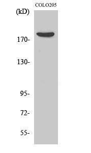 Western blot analysis of various cells using Anti-MRCKB Antibody