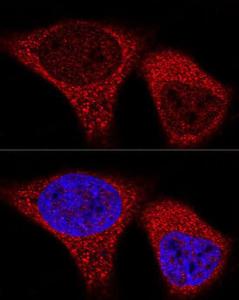 Anti-Vinculin Rabbit Monoclonal Antibody [clone: ARC51900]