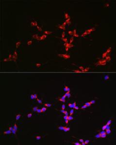 Antibody anti-GLS 100 µl