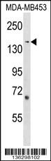 Anti-ARHGEF11 Rabbit Polyclonal Antibody