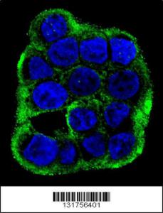 Anti-CLCN7 Rabbit Polyclonal Antibody (FITC (Fluorescein Isothiocyanate))