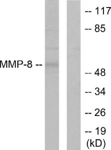 Western blot analysis of lysates from NIH/3T3 cells using Anti-MMP-8 Antibody. The right hand lane represents a negative control, where the antibody is blocked by the immunising peptide