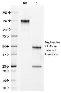 Anti-Androgen Receptor Mouse Monoclonal Antibody [clone: AR441]