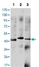 Anti-OTX2 Mouse Monoclonal Antibody [clone: 1H12C4B5]