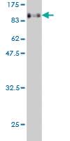 Anti-EIF4G3 Mouse Monoclonal Antibody [clone: 1D7]