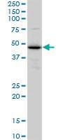 Anti-Thioredoxin Domain Containing 4 Mouse Monoclonal Antibody [clone: 3C7]