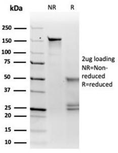 SDS-PAGE analysis of Anti-MiTF Antibody [PCRP-MITF-1D9] under non-reduced and reduced conditions; showing intact IgG and intact heavy and light chains, respectively. SDS-PAGE analysis confirms the integrity and purity of the antibody