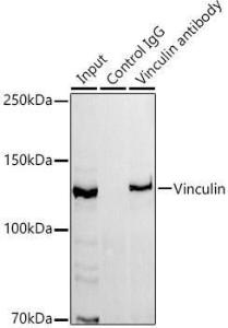 Anti-Vinculin Rabbit Monoclonal Antibody [clone: ARC51900]