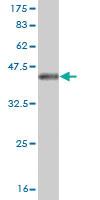 Anti-NUDT5 Mouse Monoclonal Antibody [clone: 2A3]