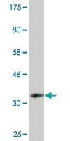 Anti-RFC1 Mouse Monoclonal Antibody [clone: 3F8]