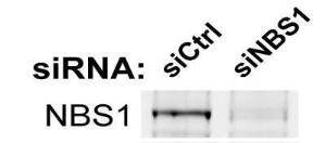 Anti-NBS1 Rabbit Polyclonal Antibody