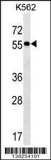 Anti-FRMD8 Rabbit Polyclonal Antibody (AP (Alkaline Phosphatase))