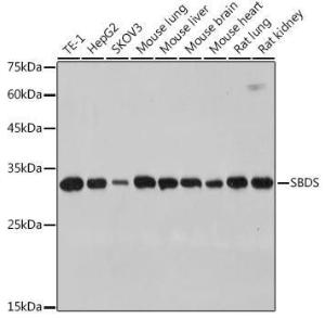 Western blot analysis of extracts of various cell lines, using Anti-SBDS Antibody [ARC2539] (A306464) at 1:1,000 dilution