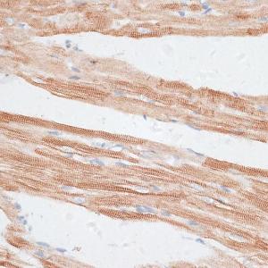 Immunohistochemistry analysis of paraffin-embedded rat heart using Anti-GRK5 Antibody (A11696) at a dilution of 1:100 (40x lens). Perform microwave antigen retrieval with 10 mM PBS buffer pH 7.2 before commencing with IHC staining protocol