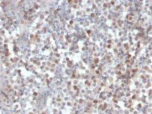 Immunohistochemical analysis of formalin-fixed, paraffin-embedded human kidney using Anti-RAD51 Antibody [RAD51/2856]