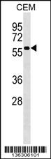 Anti-PI4K2A Rabbit Polyclonal Antibody