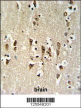 Anti-KCTD1 Rabbit Polyclonal Antibody