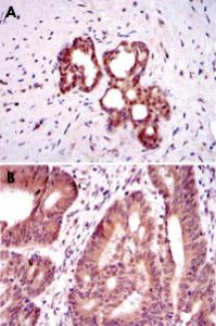 Anti-OTX2 Mouse Monoclonal Antibody [clone: 1H12C4B5]