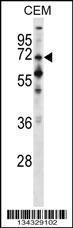 Anti-PPEF1 Rabbit Polyclonal Antibody (APC (Allophycocyanin))