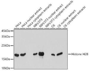 Western blot analysis of extracts of various cell lines, using Anti-Histone H2B Antibody [ARC2337] (A306466) at 1:1,000 dilution. The secondary antibody was Goat Anti-Rabbit IgG H&L Antibody (HRP) at 1:10,000 dilution.