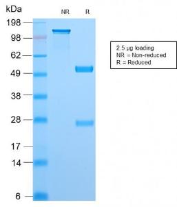 SDS-PAGE analysis of Anti-TOP1MT Antibody [TOP1MT/2883R] under non-reduced and reduced conditions; showing intact IgG and intact heavy and light chains, respectively. SDS-PAGE analysis confirms the integrity and purity of the antibody.